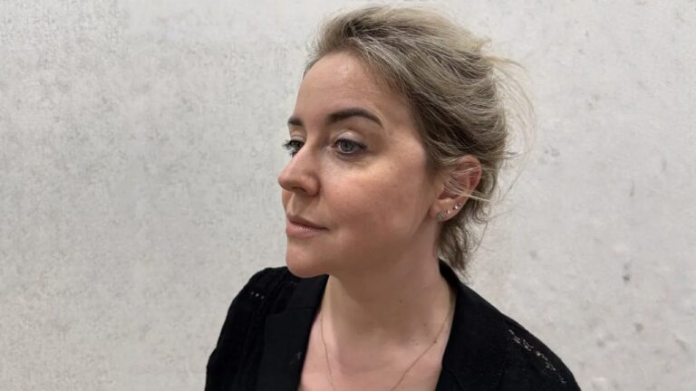 Отзыв: Елена, абдоминопластика и липосакция