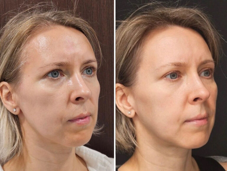 Весенние процедуры: лицо и тело