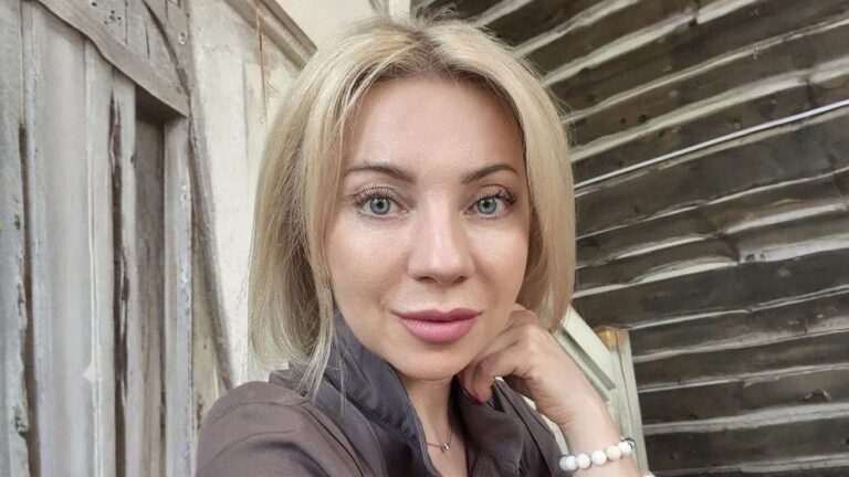 SMAS лифтинг и блефаропластика – отзыв пациента